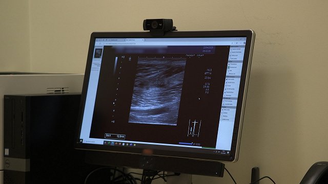 Ultrasonogrāfistu asociācija: Valsts tarifs par speciālistu darbu ir neadekvāti zems Ultrasonogrāfistu asociācija: Valsts tarifs par speciālistu darbu ir neadekvāti zems